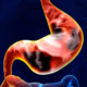 gastric-adenocarcinoma-ramucirumab-cyramza-pembrolizumab-nivolumab-trastuzumab-dmmr-msi-her2-vegf-vegfr-gastric-cancer-gej-gastroesophageal-junction-cancer-pd-1-pd-l1-eli-lilly-lilly