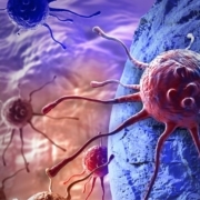 Carboplatin-plus-paclitaxel-to-be-the-new-standard-of-care-for-anal-cancer