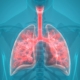 triple-combination-effective-for-hospital-and-ventilator-acquired-pneumonia