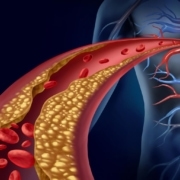 data-for-safe-and-effective-use-of-evolocumab-in-paediatric-familial-hypercholesterolaemia
