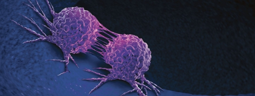 Emerging options for the treatment of metastatic hormone-sensitive prostate cancer