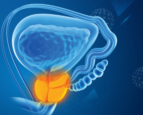 MPR-BAY-2022196 How novel hormonal agents are changing treatment paradigms in advanced prostate cancer