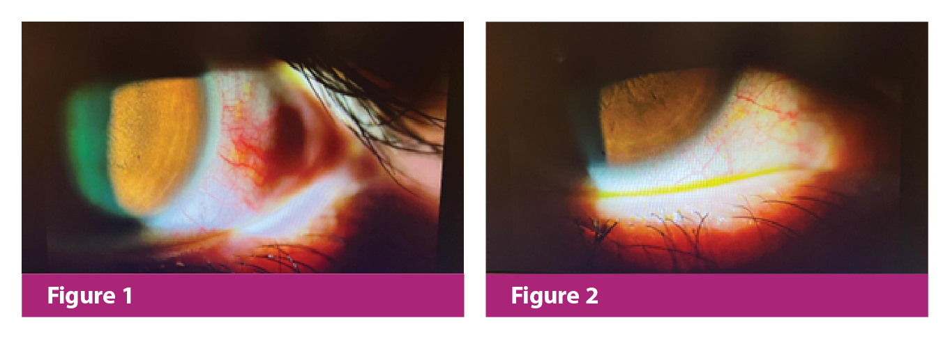 MPR-SAN-2022174 Case sharing 2_website_Figure 1-2