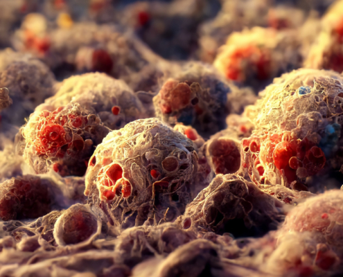 Advances in Gastrointestinal Cancer Treatment: Insights from ASCO 2024
