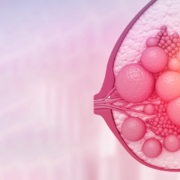 Triple-Negative Breast Cancer: Insights from ASCO 2024