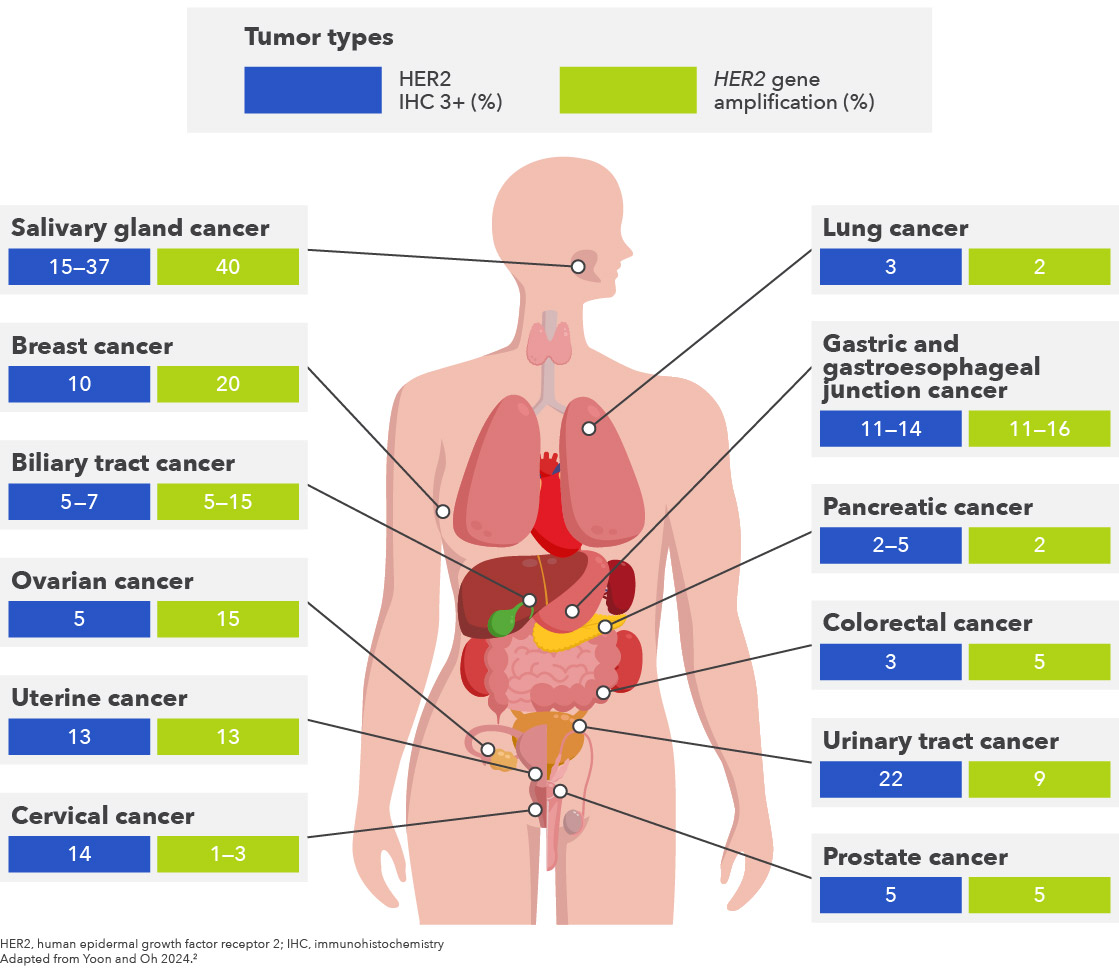 Figure 2. Prevalence of HER2 amplification and mutations, and HER2 overexpression by tumor types.